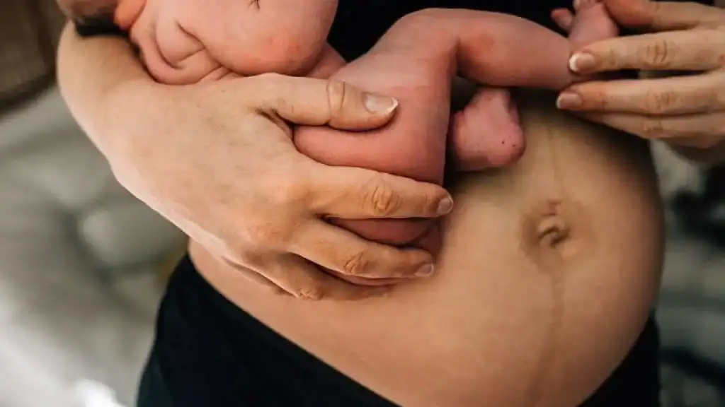 Why Is My Stomach Still Big After Pregnancy Merry Hill?
